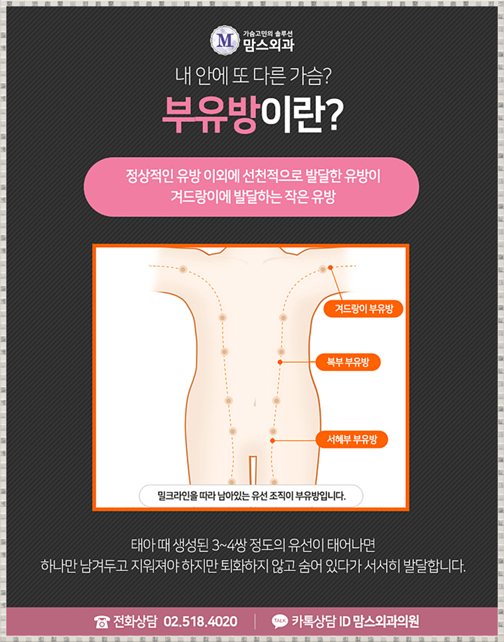 겨드랑이부유방제거 혼자선 안되니까~ 관련 이미지 3