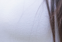 Careful Axillary Lump Clinic: Comprehensive Postoperative Support, Including Scar Care! image 21