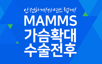 가슴확대수술전후 안전하고 아름답게 관련 이미지 6