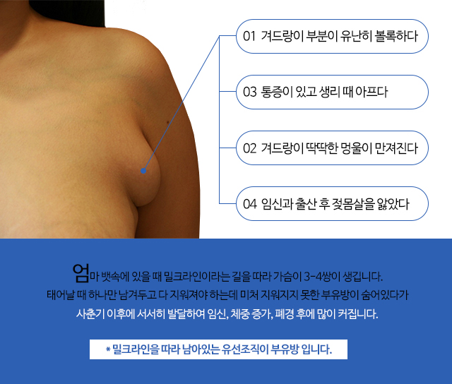 생리전겨드랑이통증 왜이럴까 관련 이미지 2