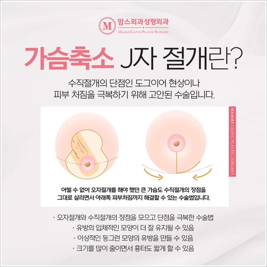 가슴축소술 든든한 마음으로 관련 이미지 6