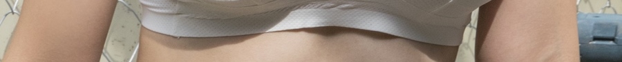 Identify the Cause of Armpit Pain image 20