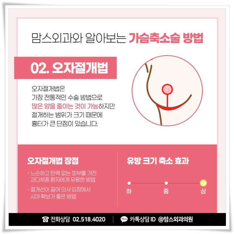 유방축소 내 몸에 맞게 관련 이미지 7