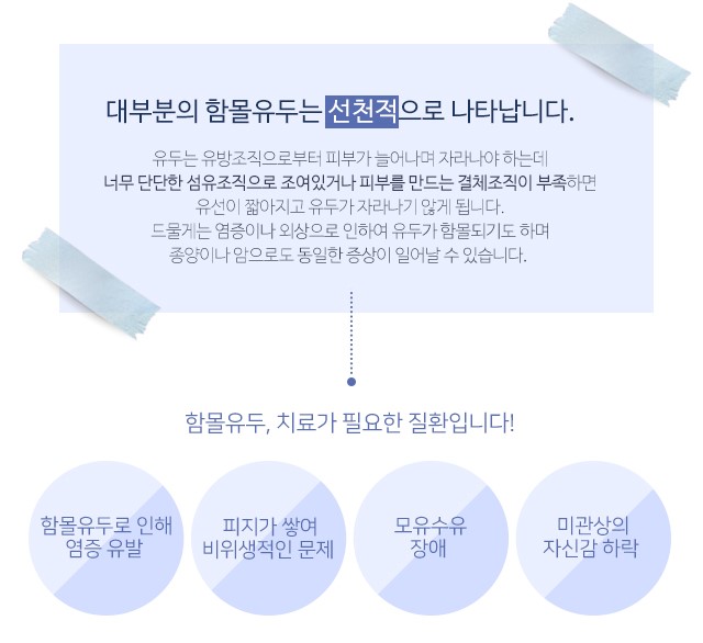 함몰유두수술후기 하나하나따져봐야죠 관련 이미지 2
