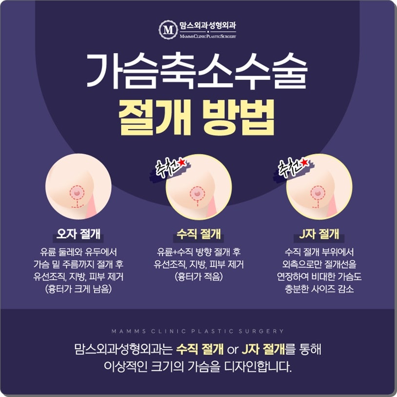 유방축소술 나를 위하여 관련 이미지 4