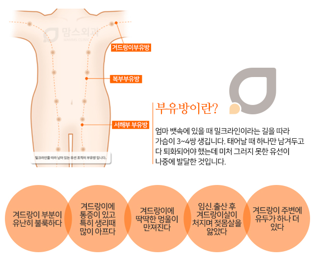 겨드랑이멍울 걱정된다면 관련 이미지 2