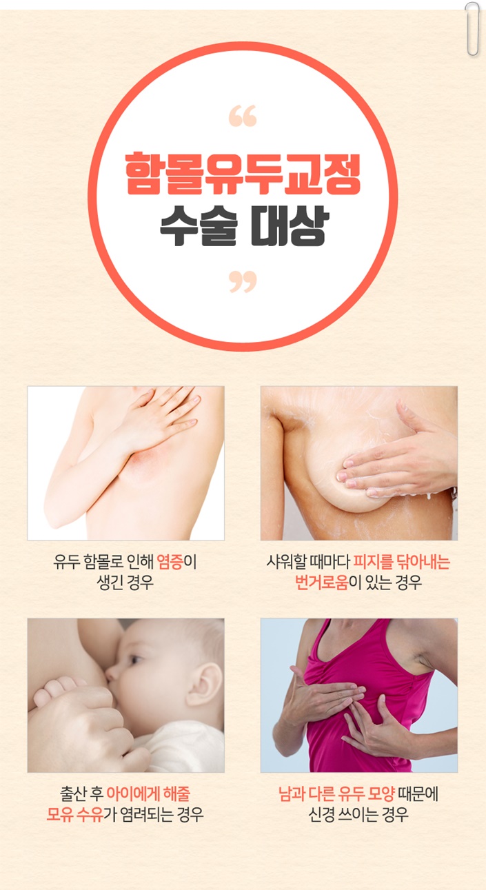 함몰유두교정 답을 찾으세요? 관련 이미지 4