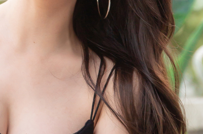 How to Minimize Scars After Breast Reduction Surgery! image 19