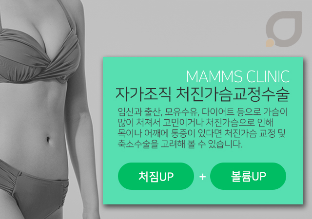가슴처짐교정 모양과촉감까지 관련 이미지 2