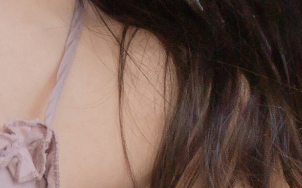Why Should You Choose Accessory Breast Surgery Instead of Accessory Breast Injections? image 21