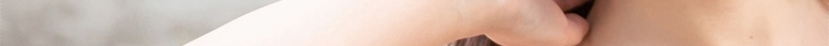 Axillary accessory breast tissue removal — does it differ case by case? image 19