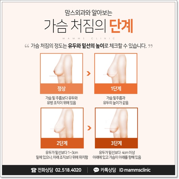 가슴거상술 무슨 생각해요? 관련 이미지 4