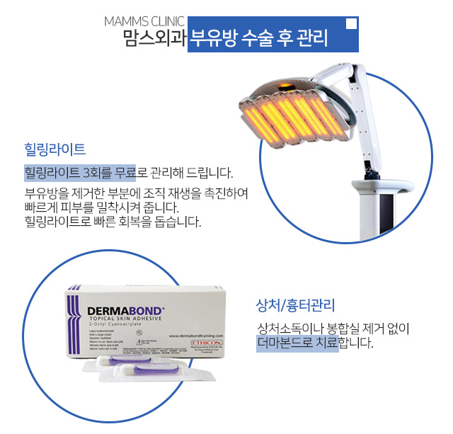 생리전겨드랑이통증 왜이럴까 관련 이미지 4