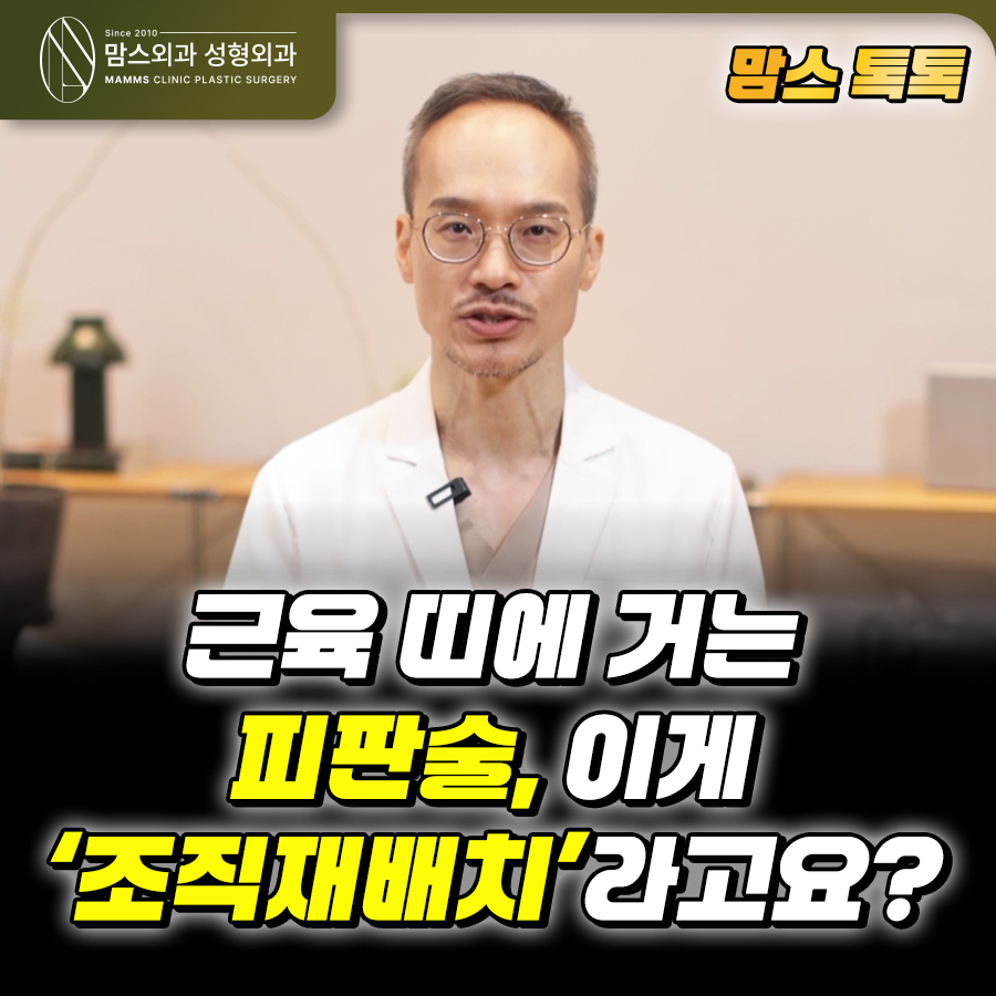 근육 띠에 거는 피판술, 이게 관련 이미지 1