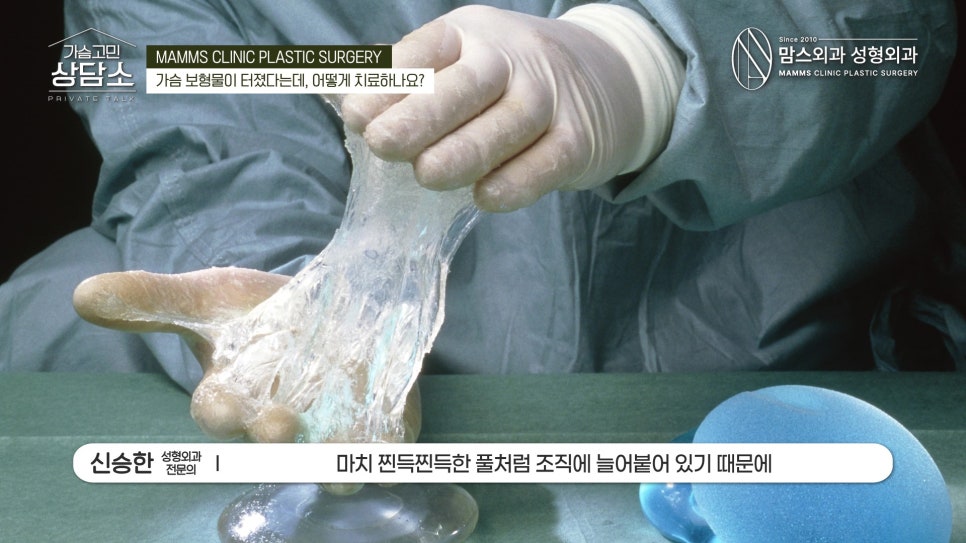 가슴 보형물 파열 피막제거는 필수입니다! 관련 이미지 4
