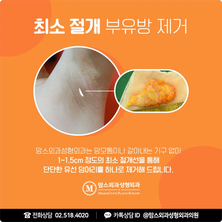 겨드랑이가아파요 고통이라면 관련 이미지 7