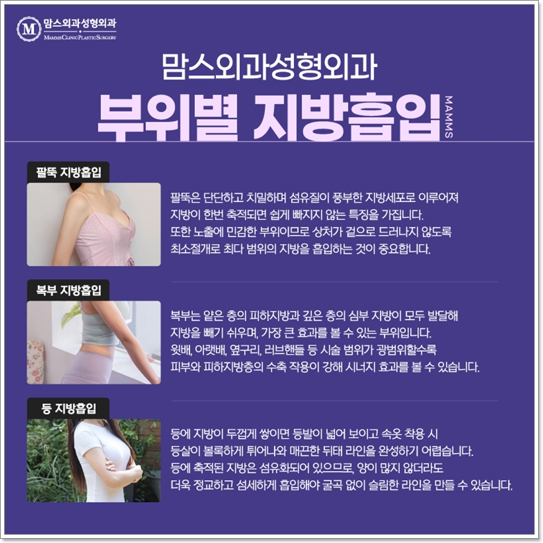 뱃살지방흡입 이럴 때도 추천한다? 관련 이미지 4