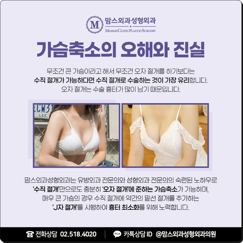 가슴축소수술병원 흉터에 대한 근심을 털어두고 관련 이미지 4