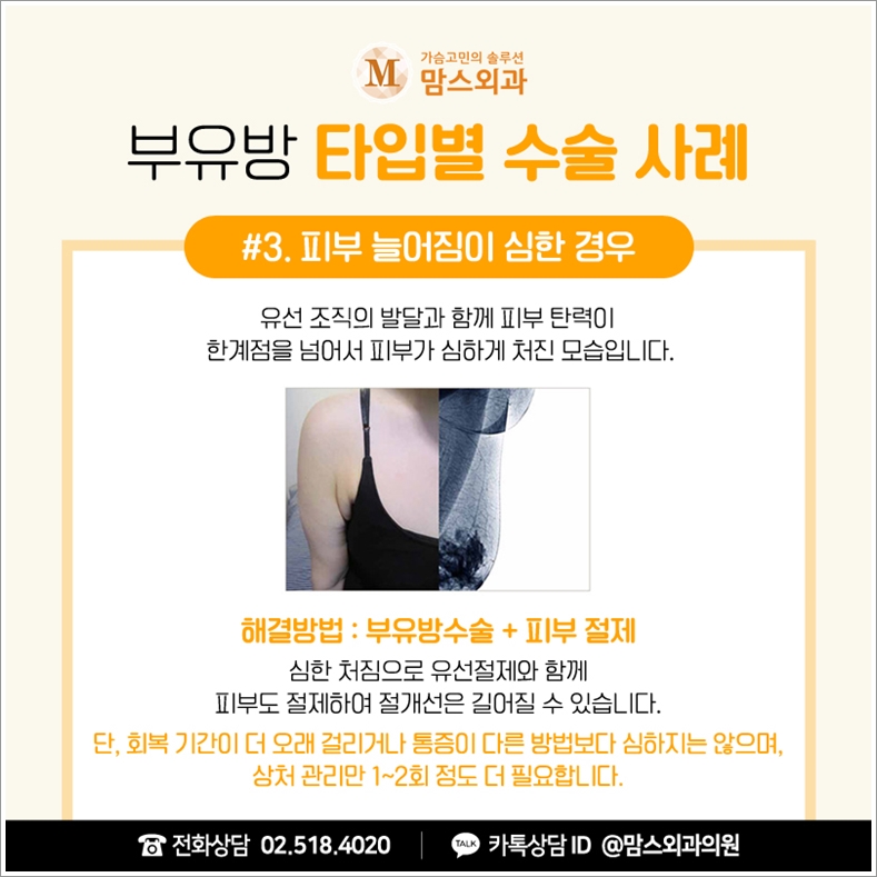 겨드랑이멍울병원 혼자 판단하기 어렵다면! 관련 이미지 7