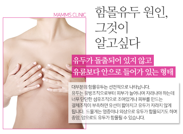 편평유두 이젠고민해결 관련 이미지 2