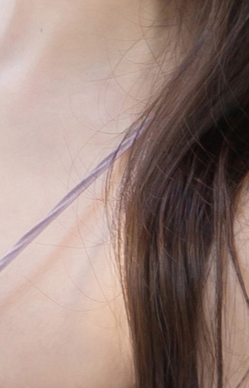 Satisfying Results from Areola Reduction Surgery image 20
