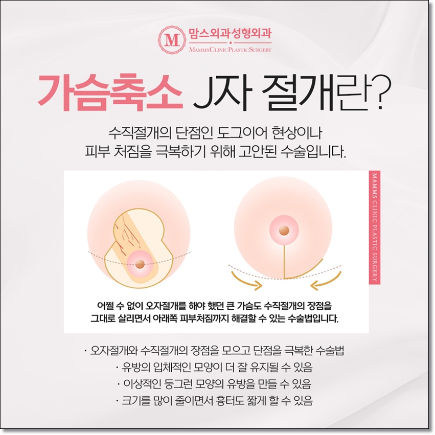 To Keep Breast Hypertrophy from Feeling Heavy image 4