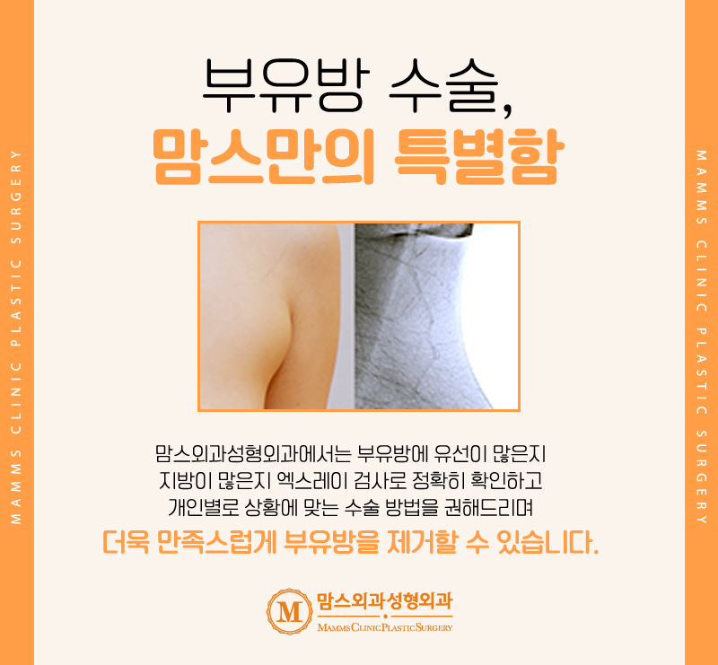 겨드랑이볼록 부유방 덜어내고 편안한 일상으로! 관련 이미지 7