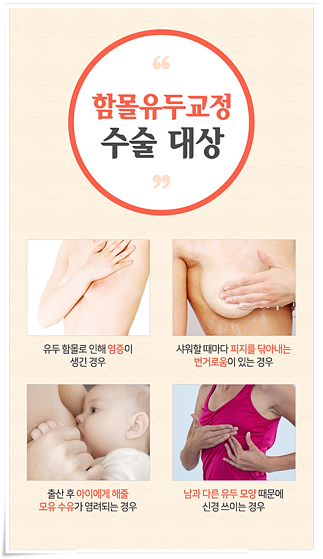 함몰유두 원인 아직까지 몰랐었지 관련 이미지 4