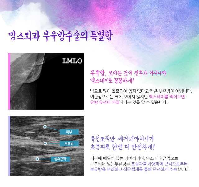 임신부유방 왜이런거죠 관련 이미지 8
