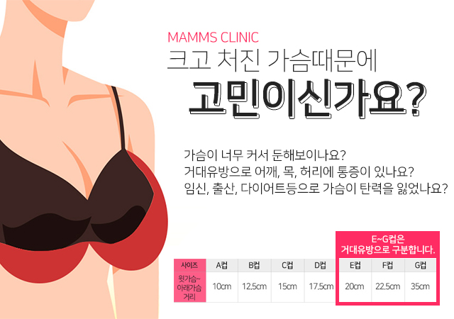 가슴축소수술후기 나에게맞게 관련 이미지 3