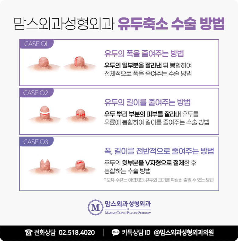 유두축소수술후기 보신 적 있나요? 관련 이미지 7