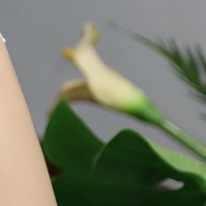 Achieving a Beautiful Appearance Through Arm Liposuction Surgery image 18