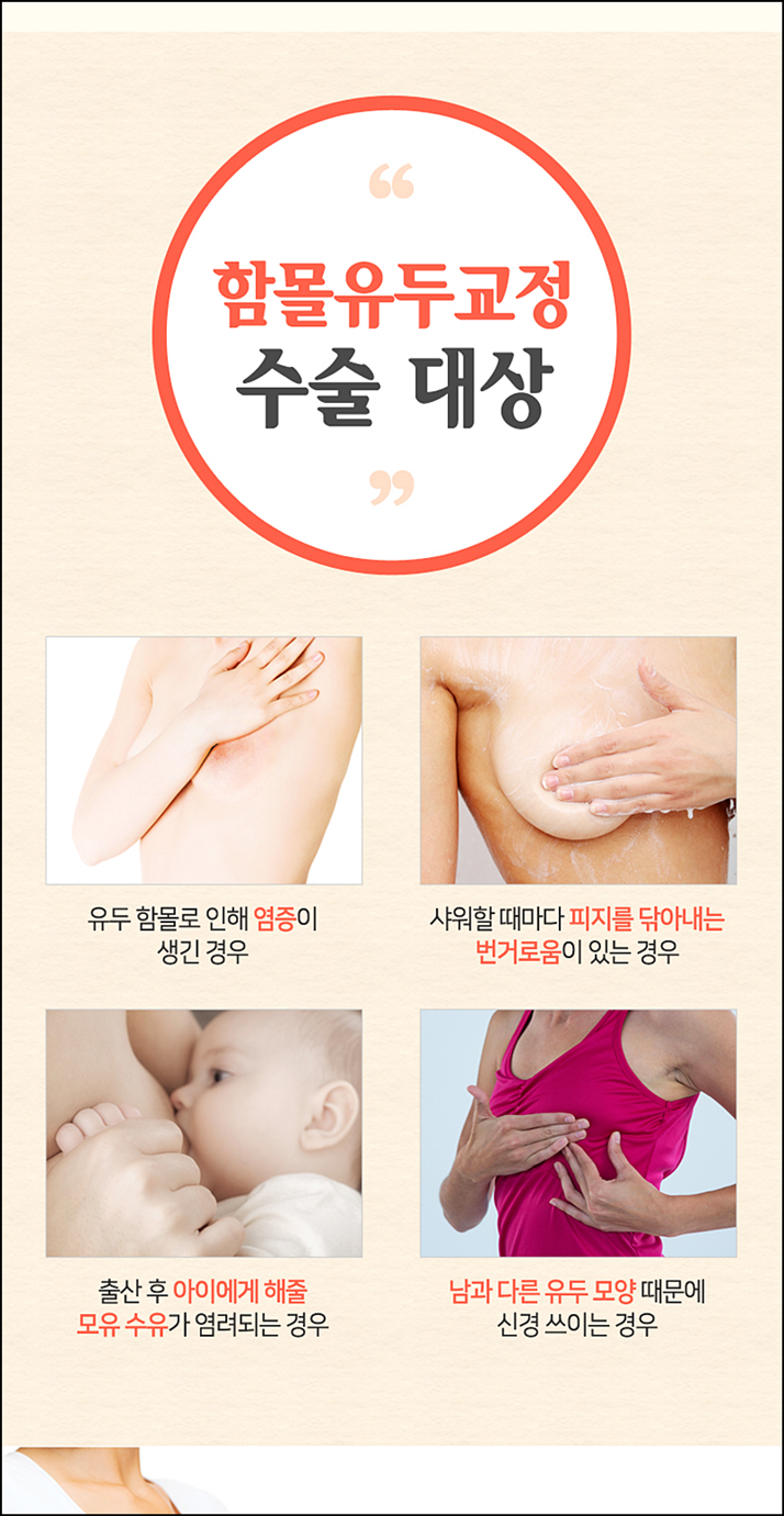 함몰유두교정 시선에 부담되니까 관련 이미지 4