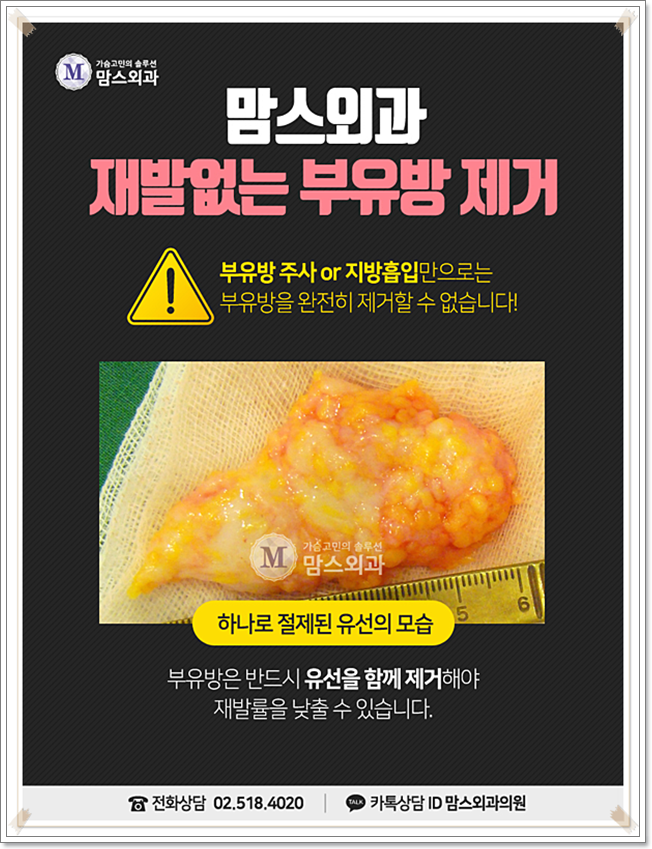 부유방외과병원 부담을 주지 않아 관련 이미지 7