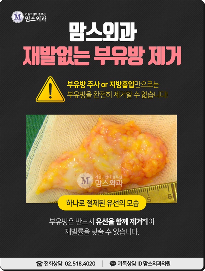 부유방수술 생각보다 간단하네! 관련 이미지 12