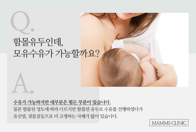 함몰유두수유 걱정덜기 관련 이미지 2