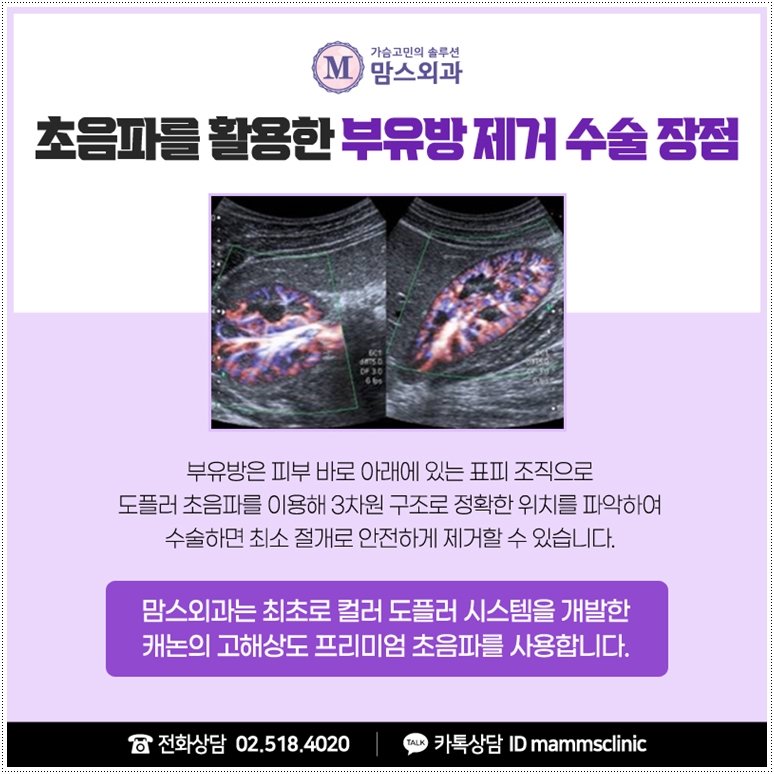 겨드랑이 부유방 감추지 마세요. 관련 이미지 7