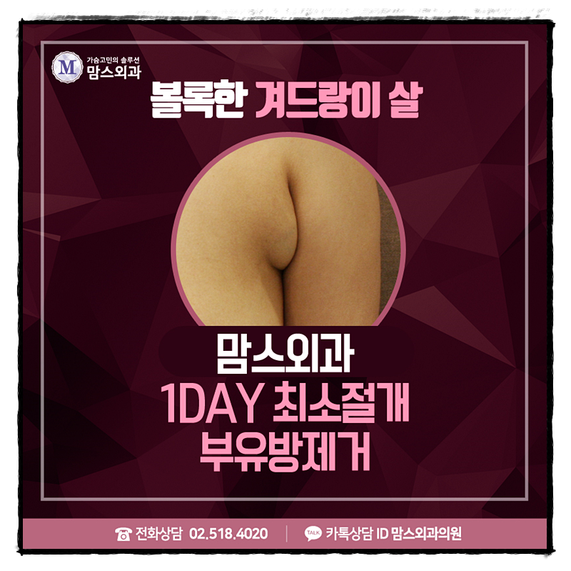 겨드랑이살빼는법 혼자서는 힘들지! 관련 이미지 1