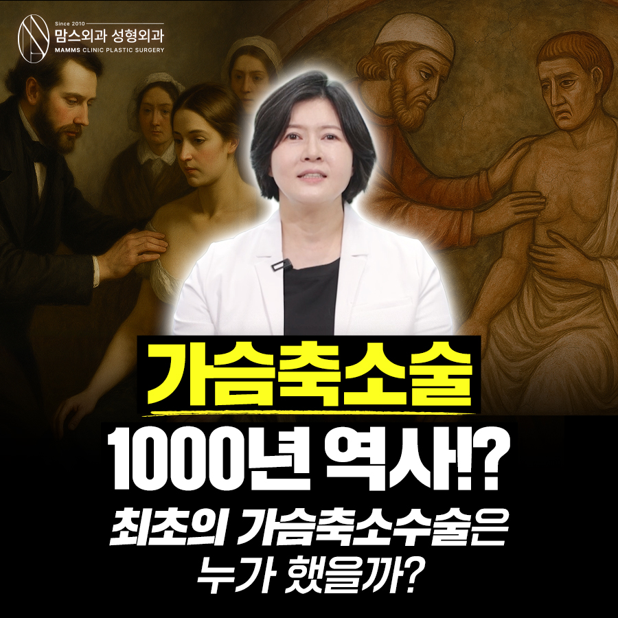가슴축소술, 1000년 진화의 역사! 최초의 가슴축소수술은 누가 했을까? 관련 이미지 1