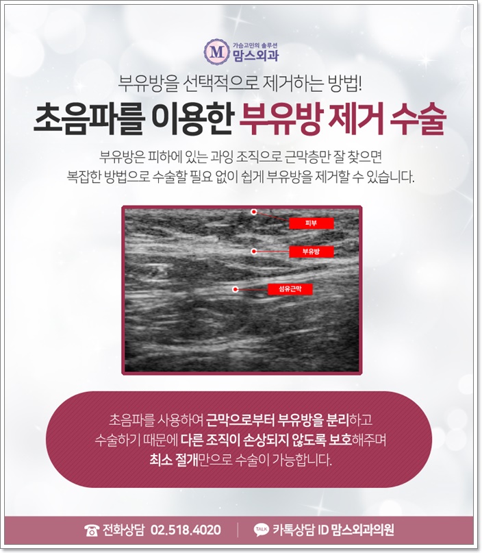 겨드랑이부유방 제거 단순하지 않아 관련 이미지 8
