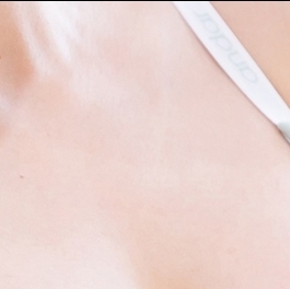 Breast Revision Surgery: What Should You Consider? image 19