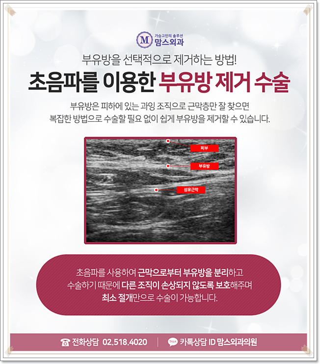 부유방외과병원 부담을 주지 않아 관련 이미지 9