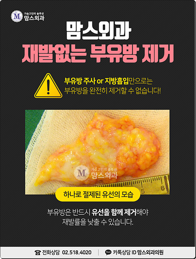 부유방통증 느껴지고 있다면 관련 이미지 2