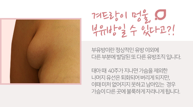 겨드랑이멍울 잡히시나요? 관련 이미지 2