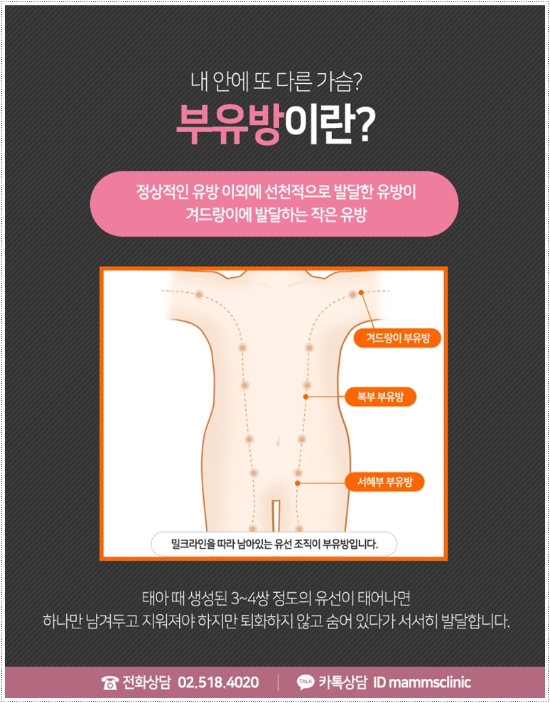 겨드랑이 부유방 감추지 마세요. 관련 이미지 2