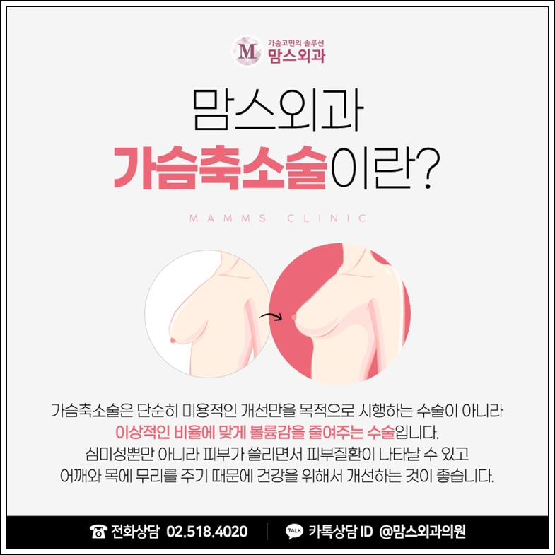 가슴축소술 흉터, 심하지 않게 관련 이미지 3