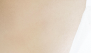 함몰유두병원 개인 맞춤형 치료가 필요한 이유? 관련 이미지 17