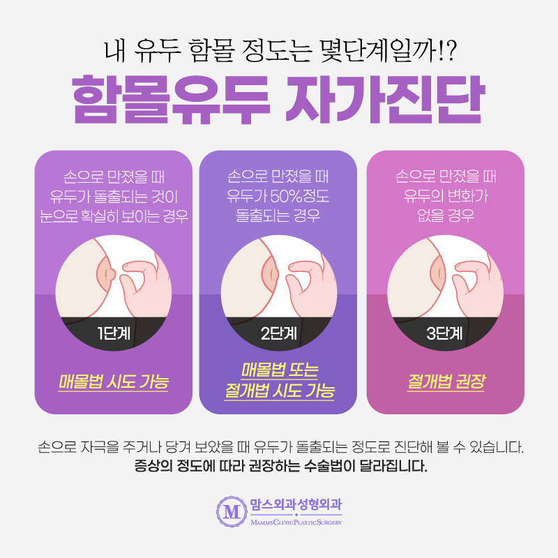 젖꼭지함몰 세심하고 꼼꼼한 상담을 통해 맞춤형 솔루션 받아보세요 관련 이미지 3