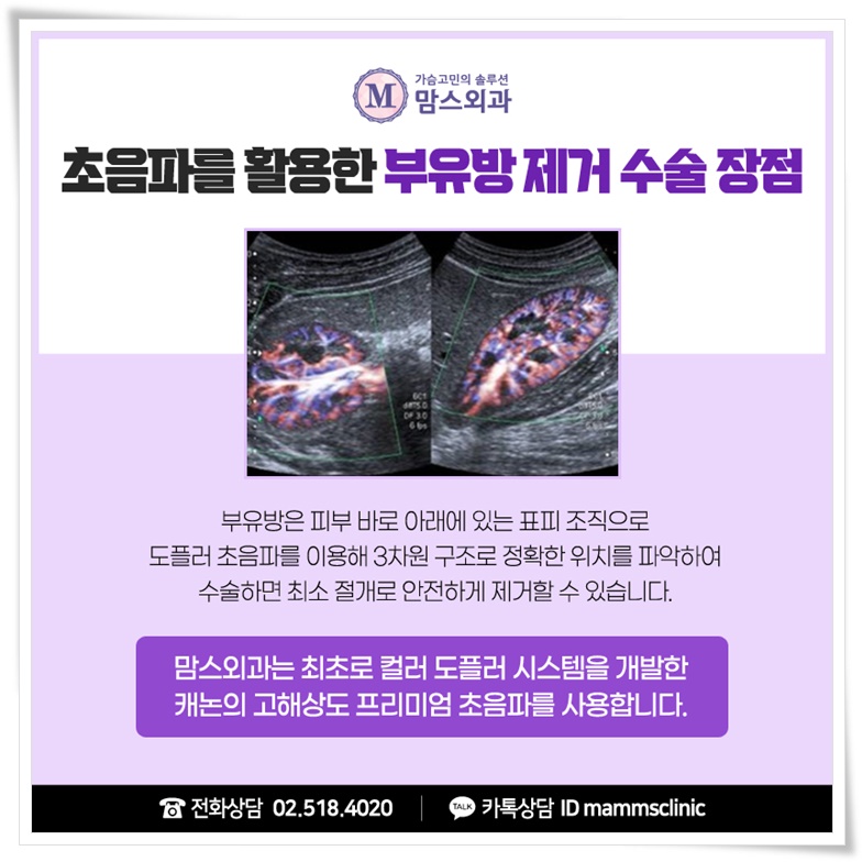 부유방제거로 삶의 질을 위해 관련 이미지 7