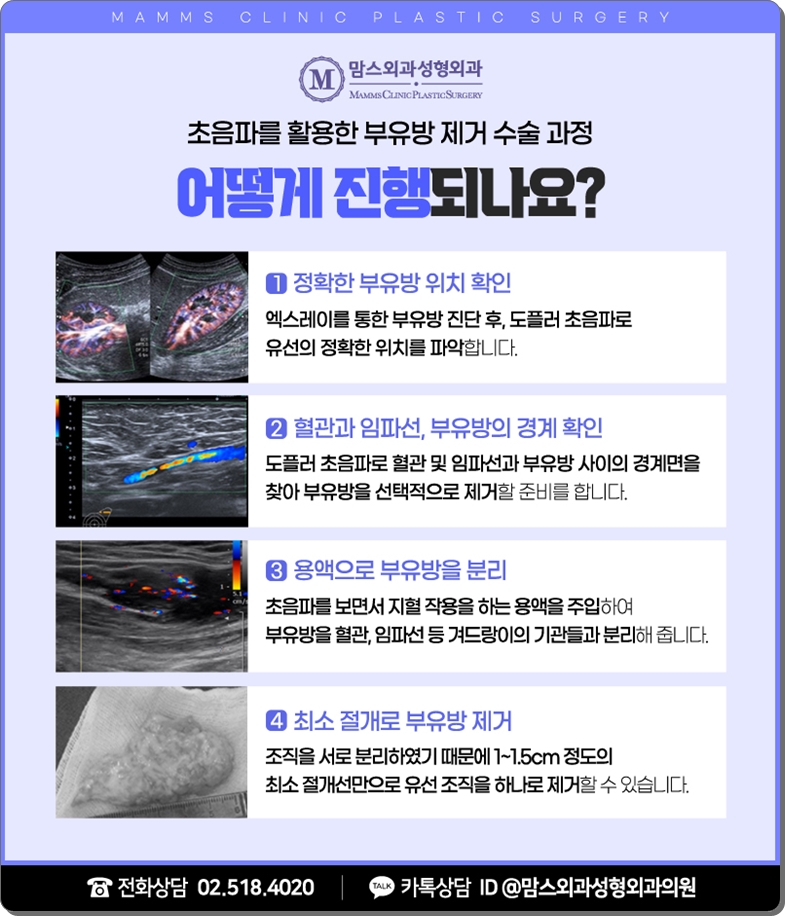 부유방제거수술 생각을 다지고 관련 이미지 6
